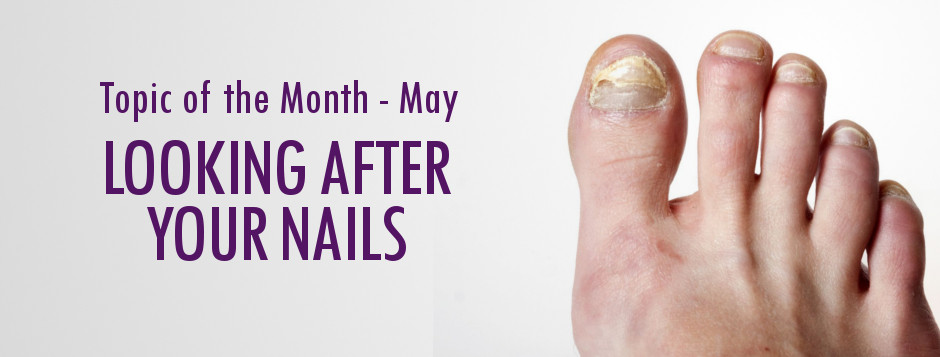 Taking Care of Your Nails - LUPUS UK